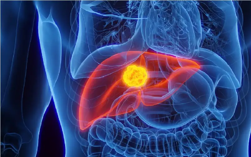 تعديل في النظام الغذائي قد يوقف