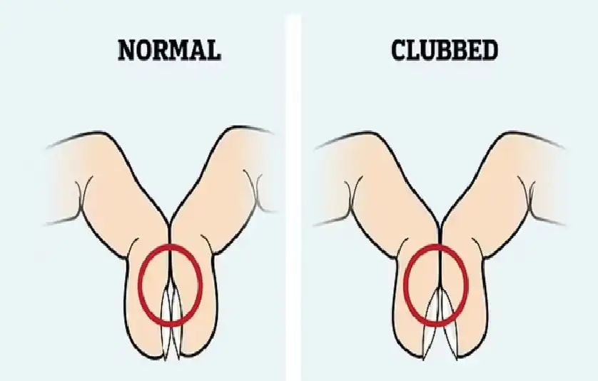انتبه لحركة أصابعك.. كيف تعرف أنك