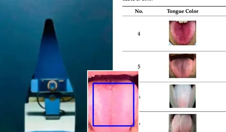ذكاء اصطناعي يشخص جميع أمراضك عبر