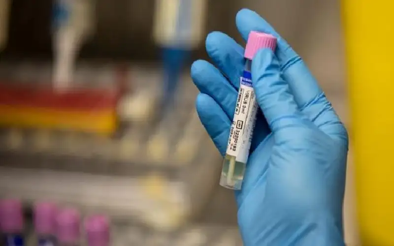 خطط طوارئ عربية لمجابهة تهديد جدري