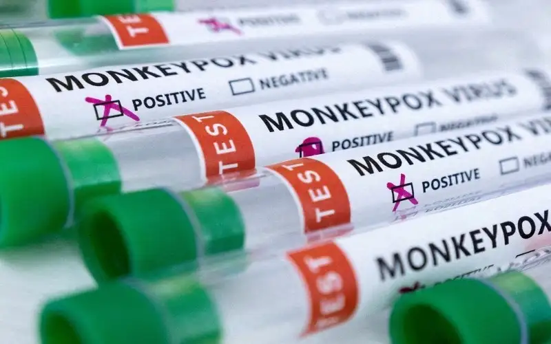 مكافحة الأوبئة: إجراءات على جميع المراكز