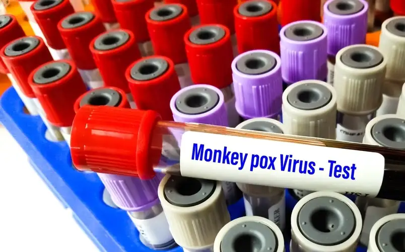 ما هو جدري القردة الذي أعلن