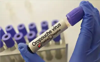 اكتشاف فيروس جديد قاتل للأطفال