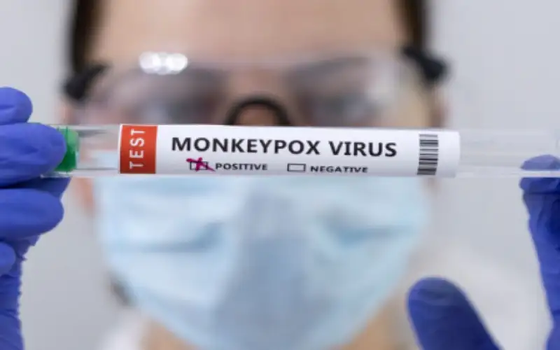 مكافحة الأوبئة يبحث الاستعداد لمواجهة فيروس