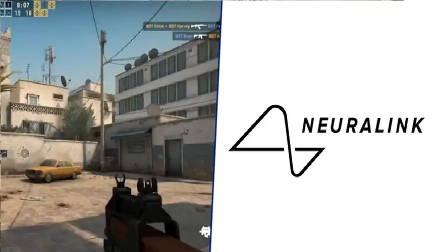 شريحة إيلون ماسك الدماغية تتيح كاونتر