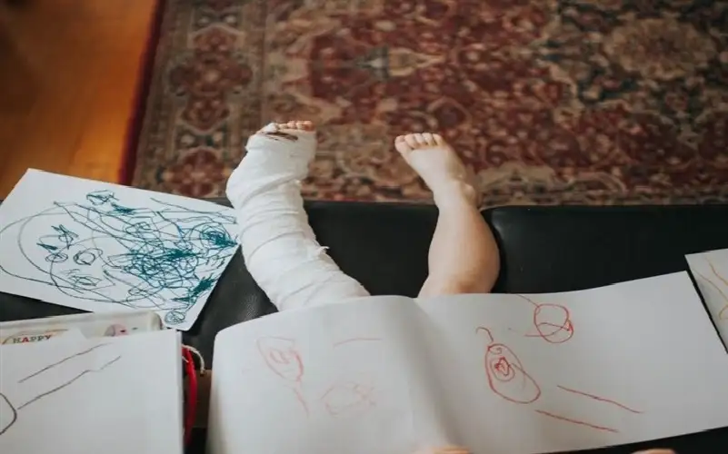 تعرف إلى طفرة خلل التنسج الليفي