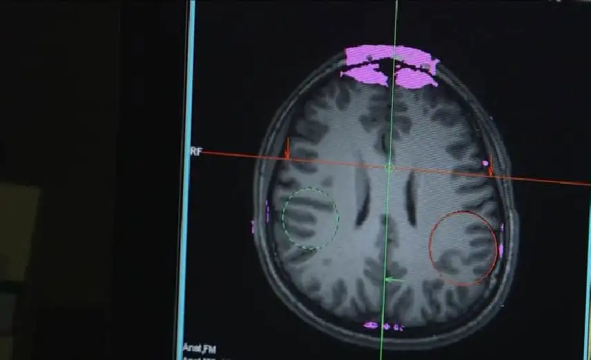 باحثون يكشفون دور المرونة في طول