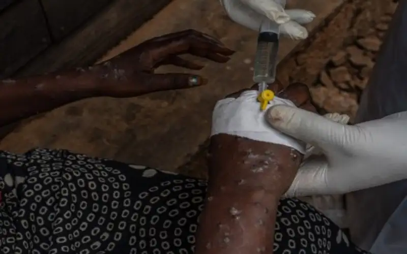 إفريقيا تنتظر تسلم مليون جرعة لقاح