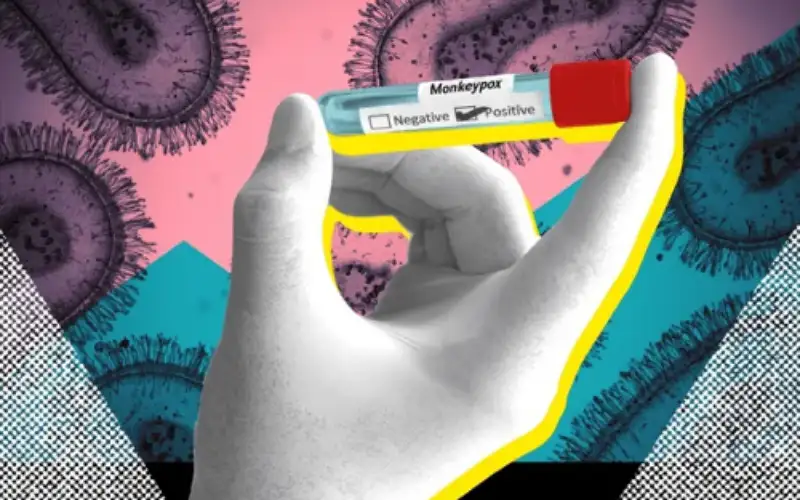 جدري القرود .. ما هو وكيف