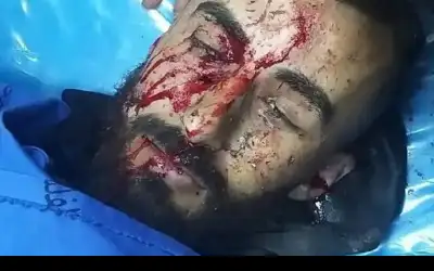 5 شهداء بقصف الاحتلال مركبة بطوباس