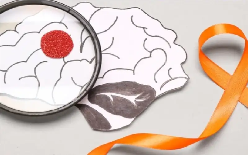 هذا المرض لا علاج له ويمكن