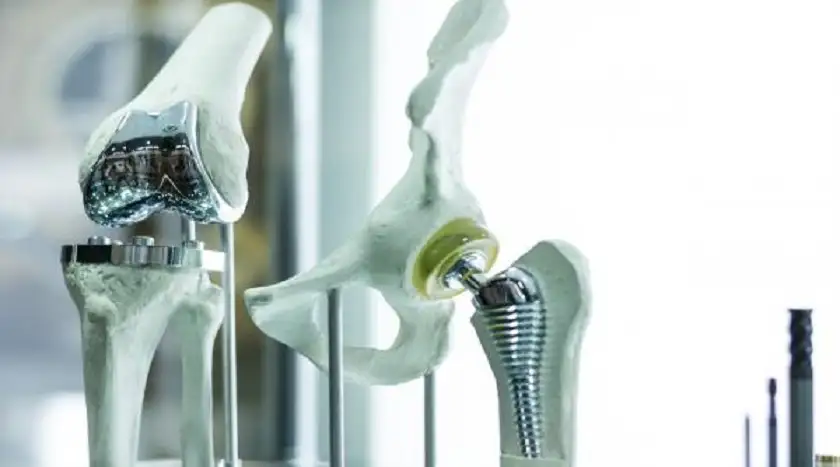 علماء يطورون أول ساق روبوتية بـعضلات