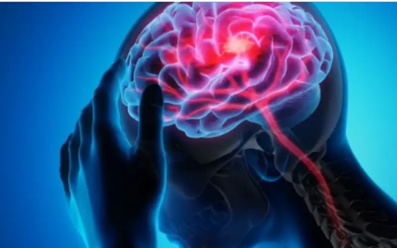 كيفية الوقاية من الجلطة الدماغية