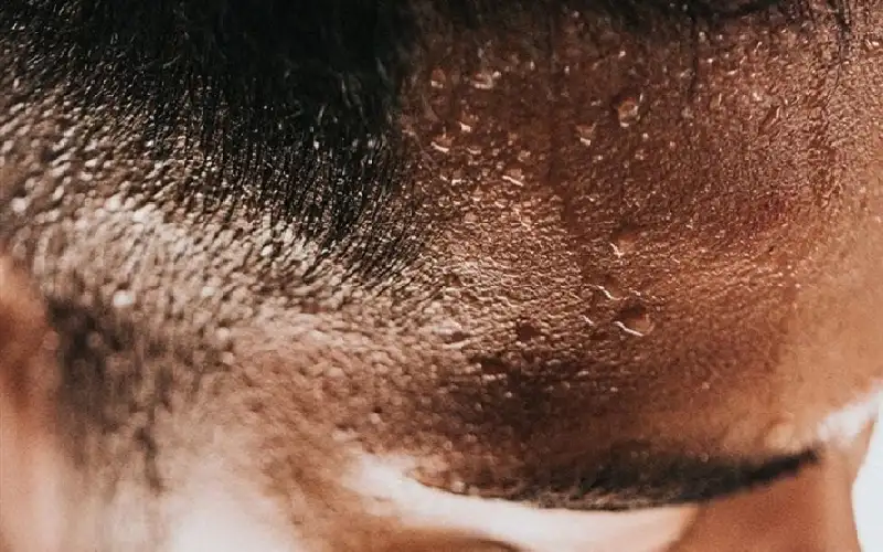 ما أسباب العرق البارد؟