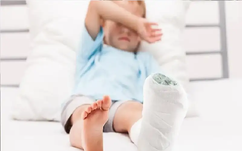 نقص فيتامين د يبطئ شفاء الكسور