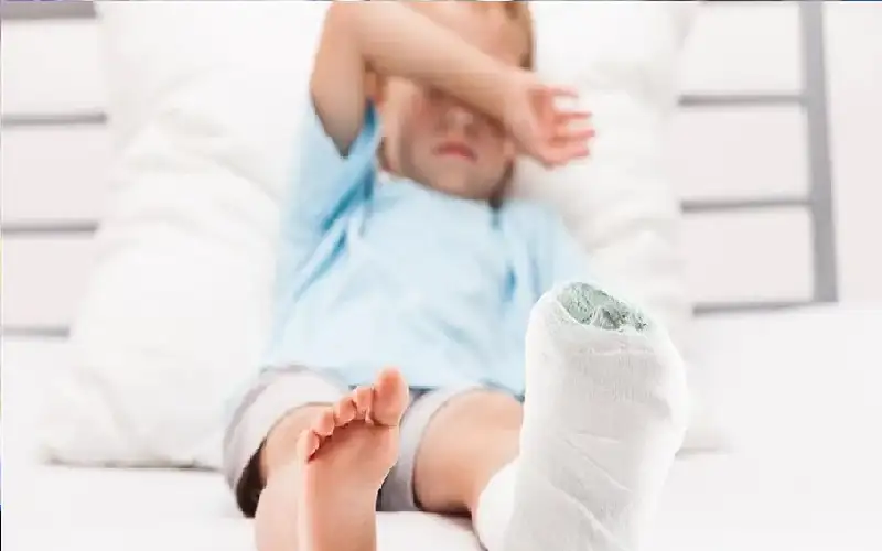 نقص فيتامين د يبطئ شفاء الكسور