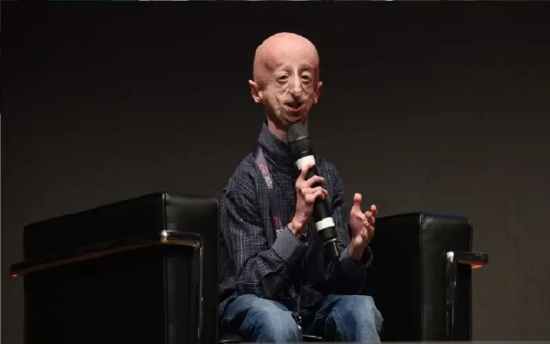 إيطاليا.. وفاة المصاب الأطول عمرا بالشيخوخة