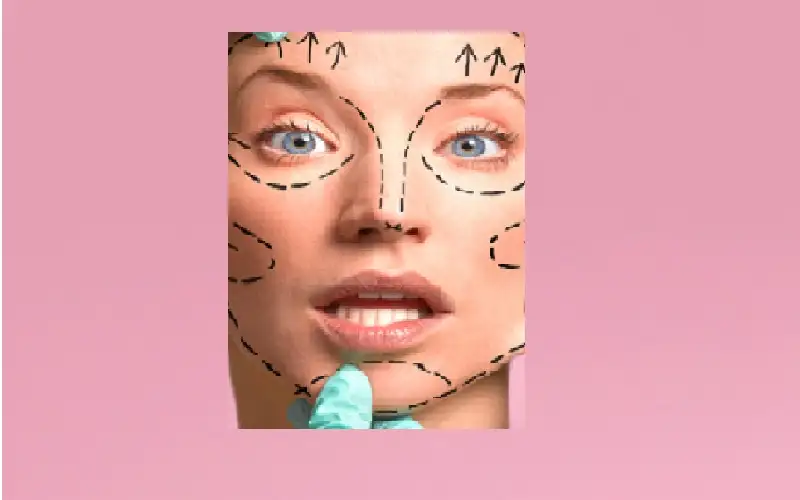 لن أقوم بها أبدا.. جراح تجميل