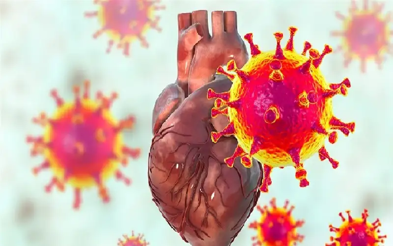 كوفيد 19 يضاعف خطر النوبة القلبية