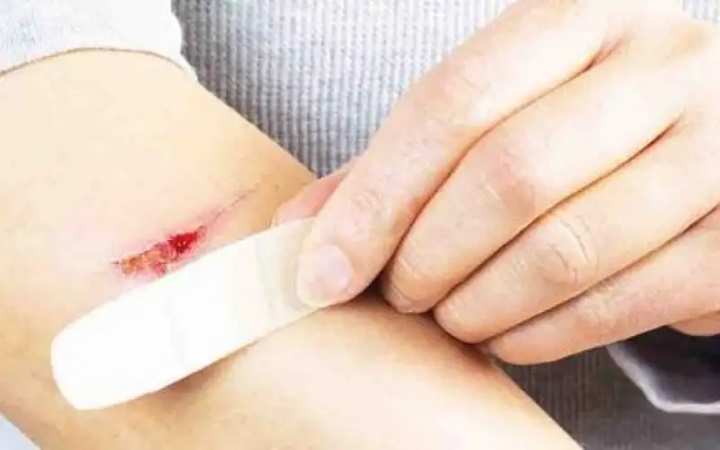 علماء صينيون يبتكرون خيوطا تسرع التئام