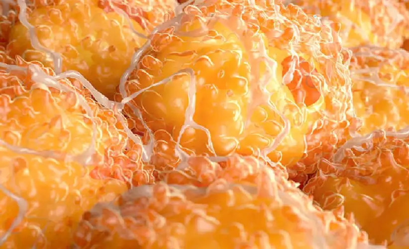 دهون الجسم عامل خطر لسرطان الثدي