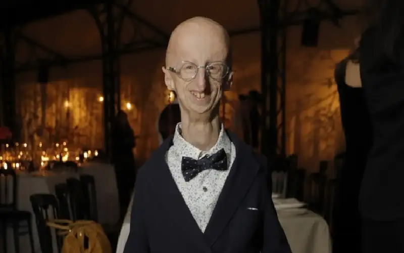 الوحيدة في إسبانيا.. قصة مؤثرة لطفلة