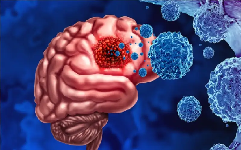 العلماء يستكشفون آليات جديدة لمكافحة ورم