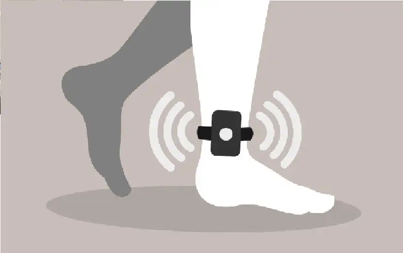 تطبيق الإسوارة الإلكترونية على 125 حالة