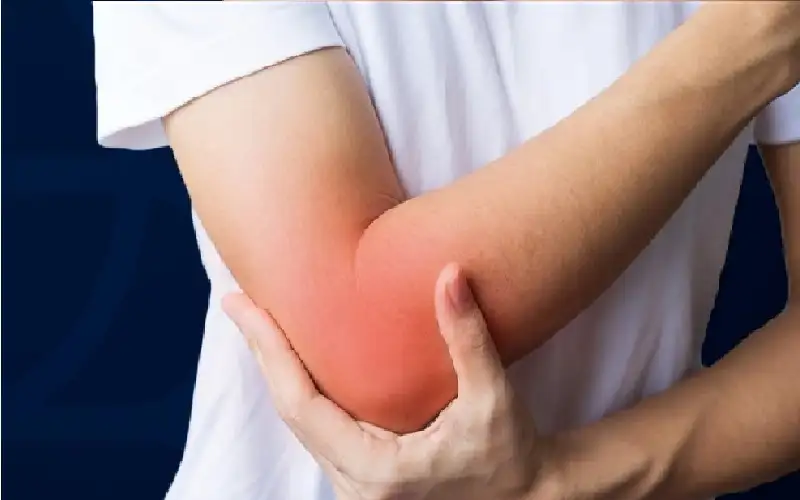 التهاب كوع التنس.. الأسباب والعلاج