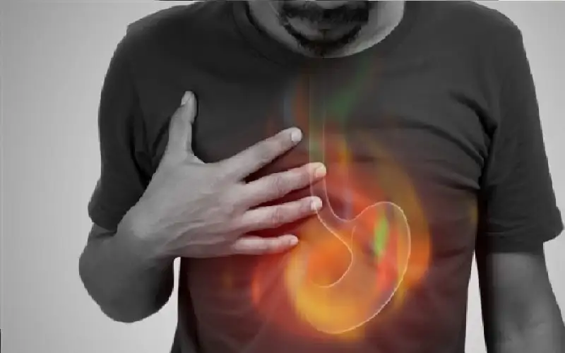 ارتجاع حمض المريء يرتبط بمشاكل الضغط