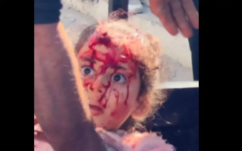 طفلة تعرض منزل ذويها للقصف.. انظر