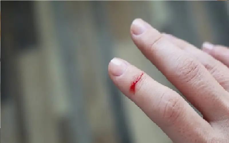 لماذا تؤلم جروح الورق بشدة؟