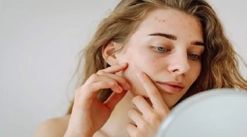 الطفح الوردي .. الأسباب والعلاج