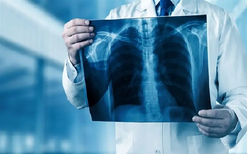 ما هو الاسترواح الصدري؟