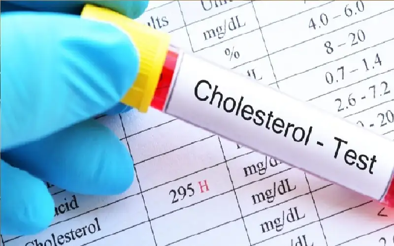 تقلب مستوى الكوليسترول يرتبط بمخاطر الخرف