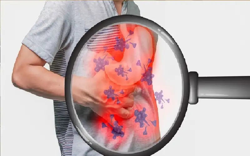 ما سبب الالتهاب المزمن وكيف يمكن