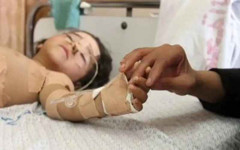 طبيب أردني: أطفال مصابون بالسرطان وصلونا