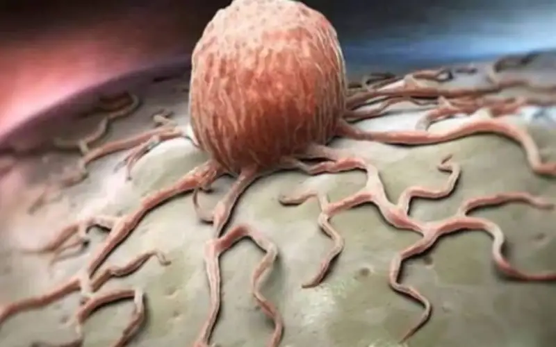 علامة قد تستهين بها تظهر انك