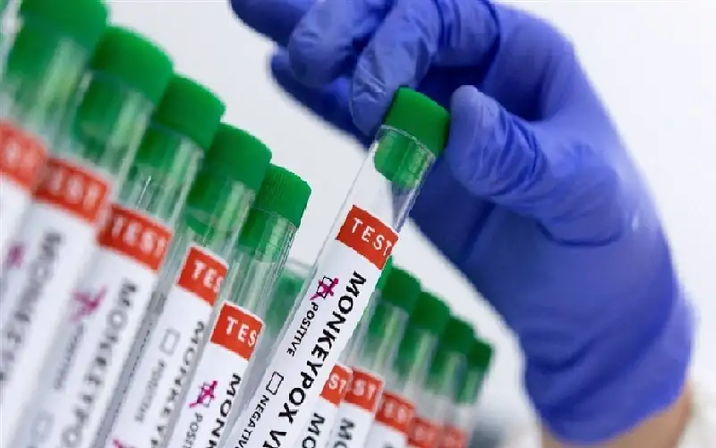 الصحة العالمية ترخص أول لقاح لجدري