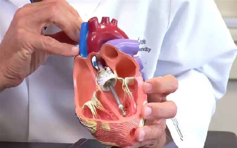 اكتشاف طريقة خفية لإصلاح خلايا القلب