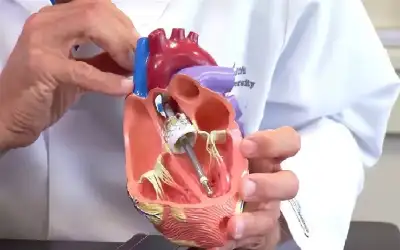 اكتشاف طريقة خفية لإصلاح خلايا القلب