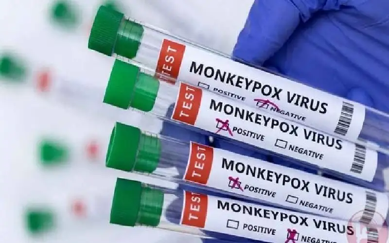 تسجيل أول إصابة بجدري القردة في