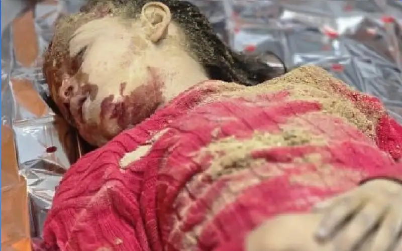 معظمهم أطفال ونساء.. شهداء وجرحى جراء