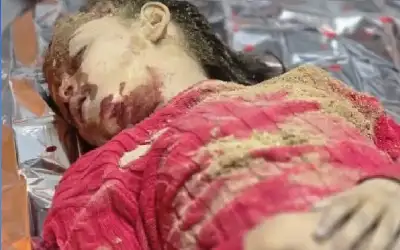 معظمهم أطفال ونساء.. شهداء وجرحى جراء