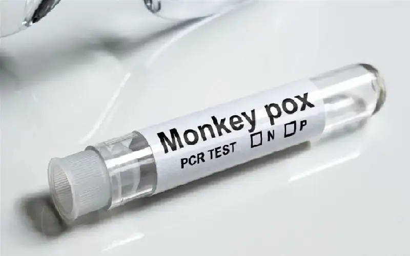 كندا ترصد أول إصابة بـ السلالة