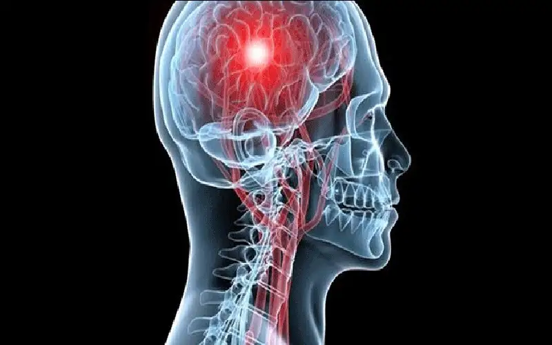 المرأة والضغط وأوزمبيك.. إرشادات جديدة للوقاية