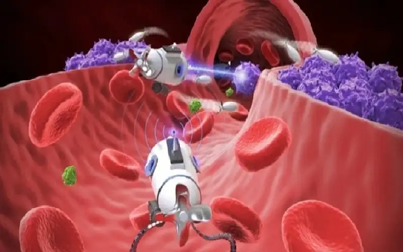 تطوير روبوتات نانوية تستهدف الأورام لتدميرها