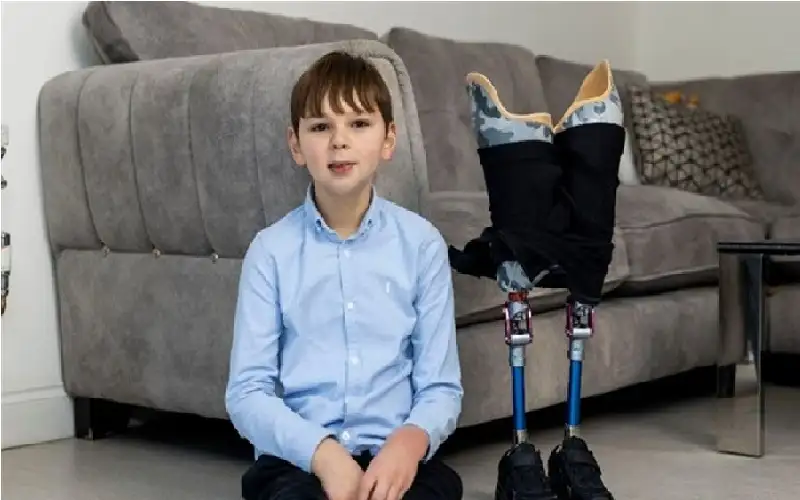 عنف أسري يتسبب ببتر ساقي طفل..