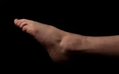 متى تكون تشنجات الساق إشارة لحالة
