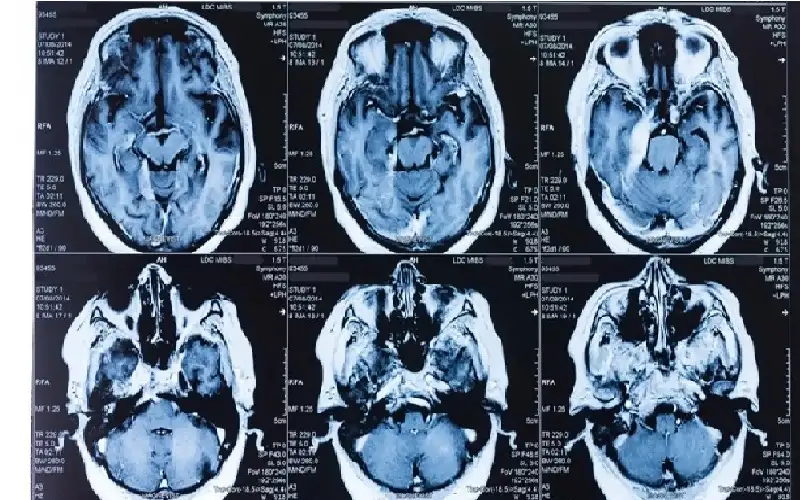 13 بروتينا في الدم يكشف العمر